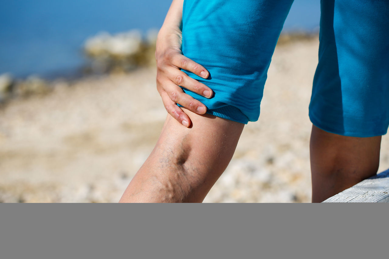 Reisethrombose vorbeugen: Das können Sie gegen geschwollene Beine tun