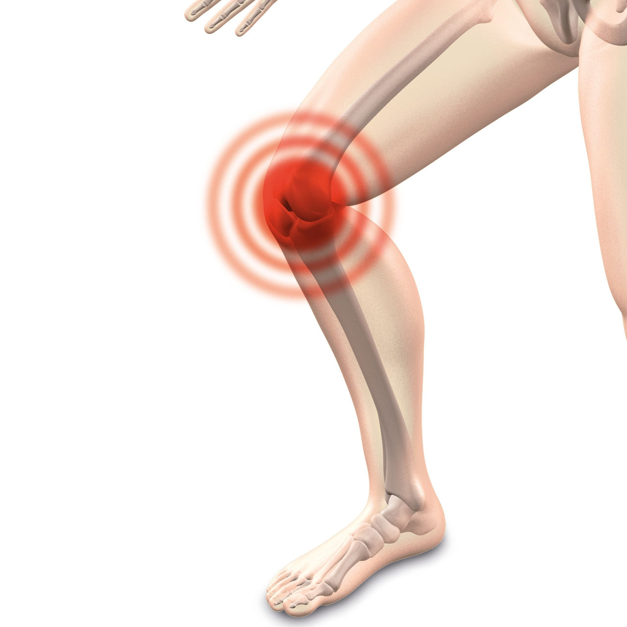 Schmerzen im Kniegelenk: Mariahilf informiert über Ursachen, Diagnose und moderner Therapie
