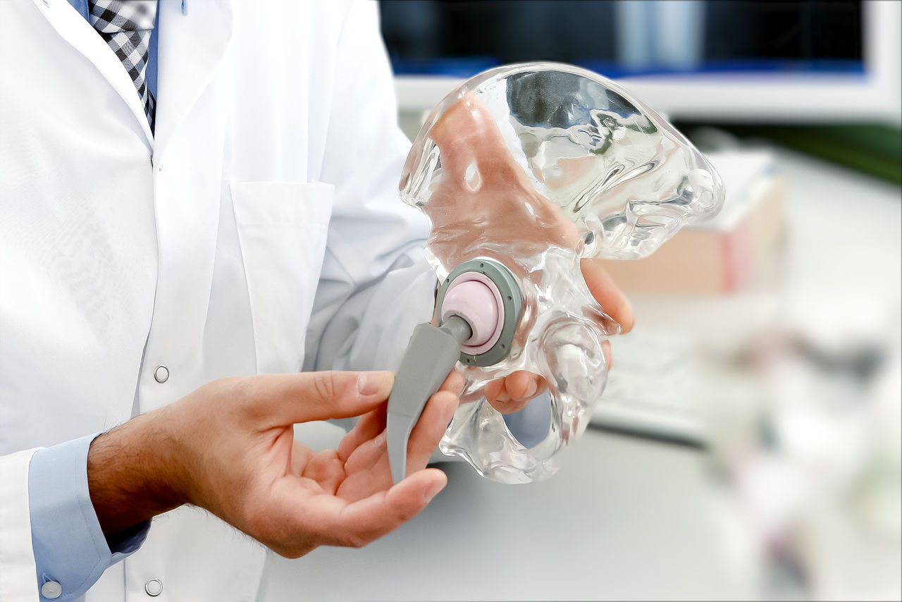 Künstlicher Hüft- & Kniegelenkersatz: Was die moderne Endoprothetik leisten kann