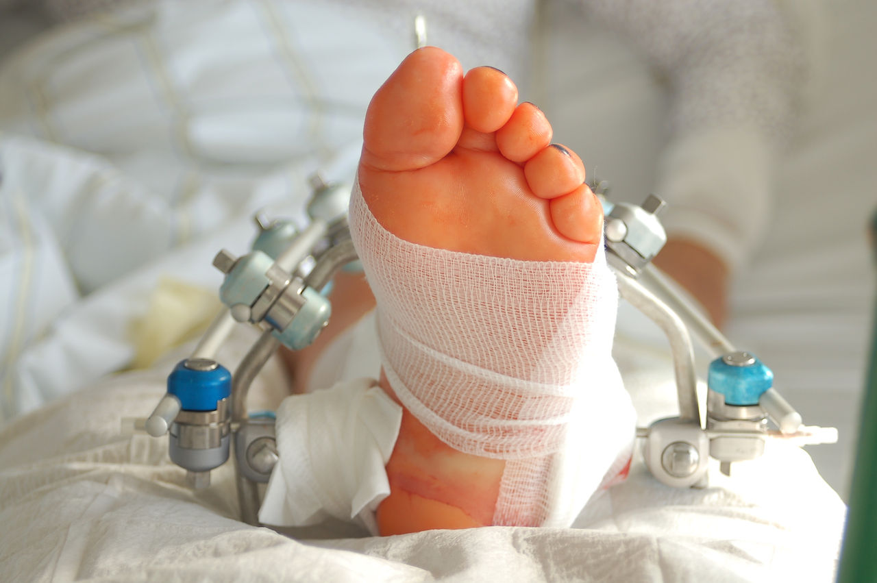 Eine Fußoperation gut meistern – wichtige Informationen zu Vor- und Nachsorge