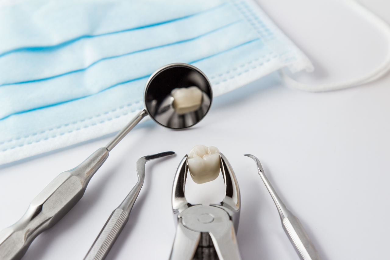 Zahnchirurgie: Wann ist eine Operation nötig? 