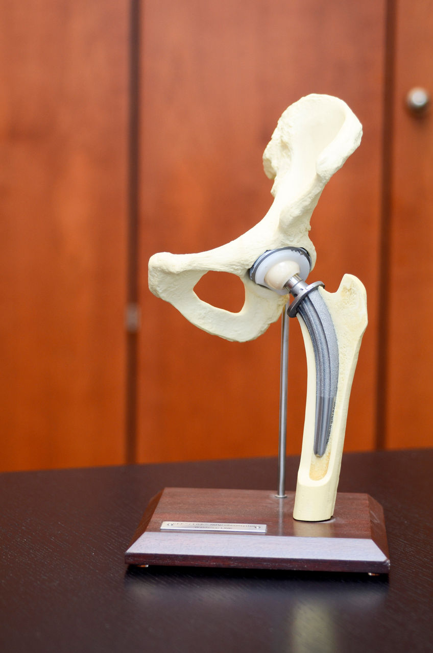 Hüftprothese: Wieder beweglich durch ein neues Hüftgelenk