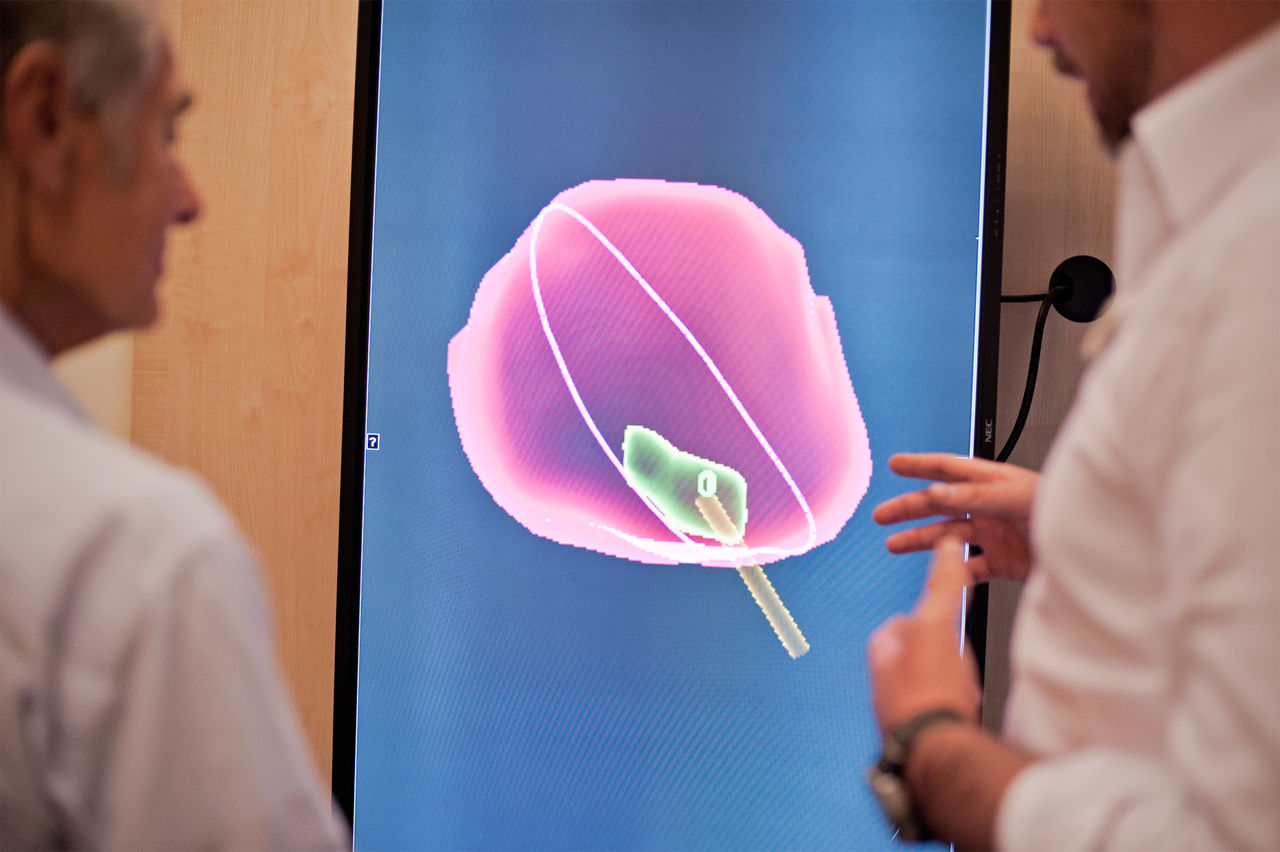 Infoveranstaltung: Prostatakrebs behandeln