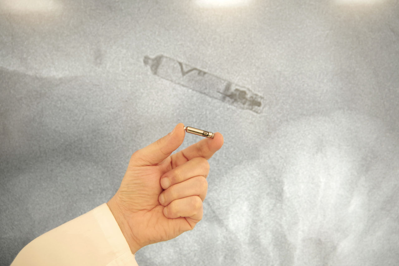 Erstmals kabelloser Herzschrittmacher an der Helios Frankenwaldklinik Kronach implantiert