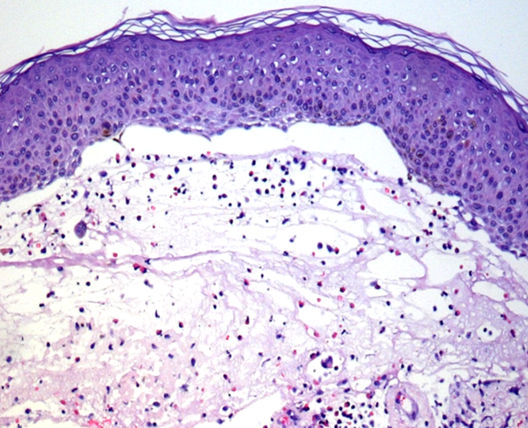 Wuppertaler Dermatologenabend