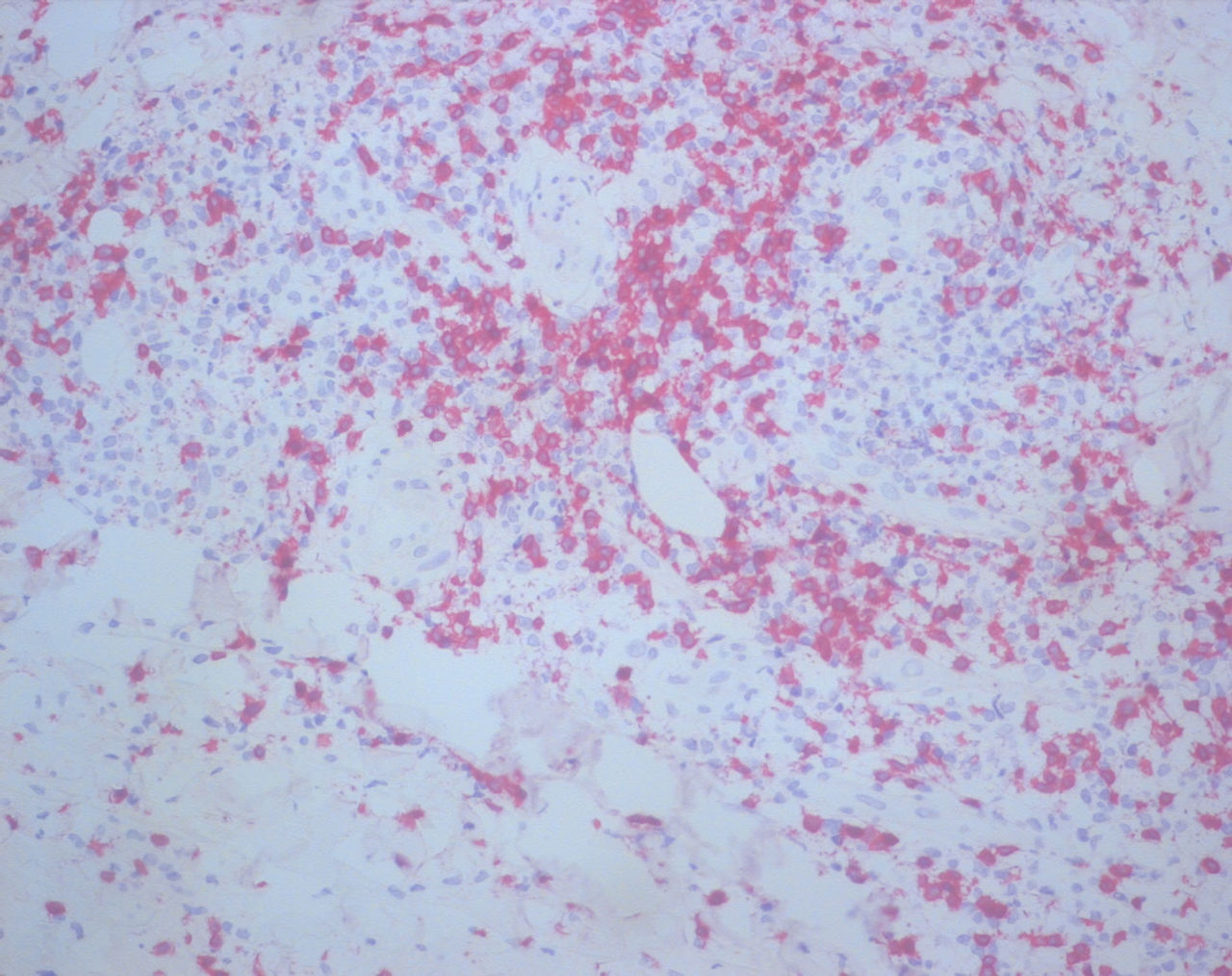 Wuppertaler Dermatologenabend 2024