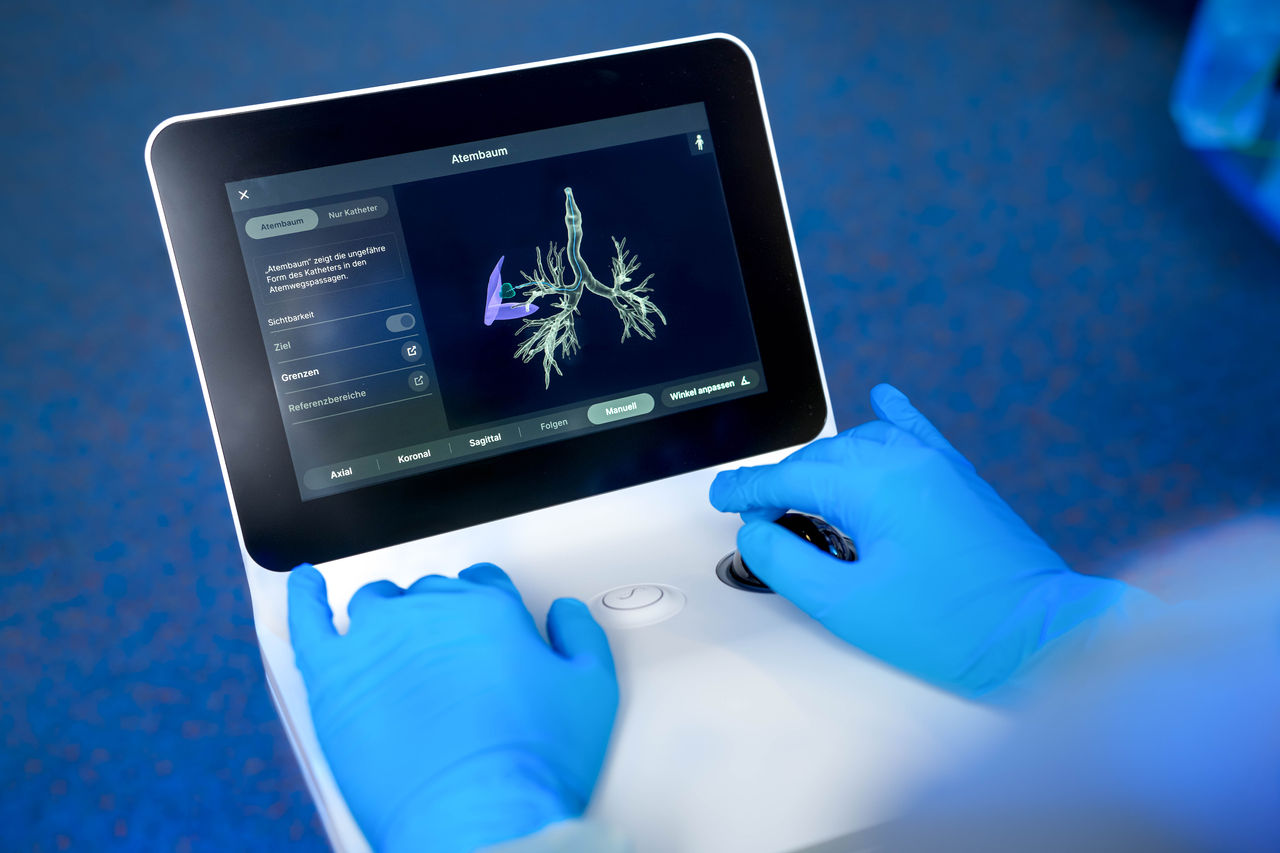 Lungenkrebsvorsorge und Früherkennung