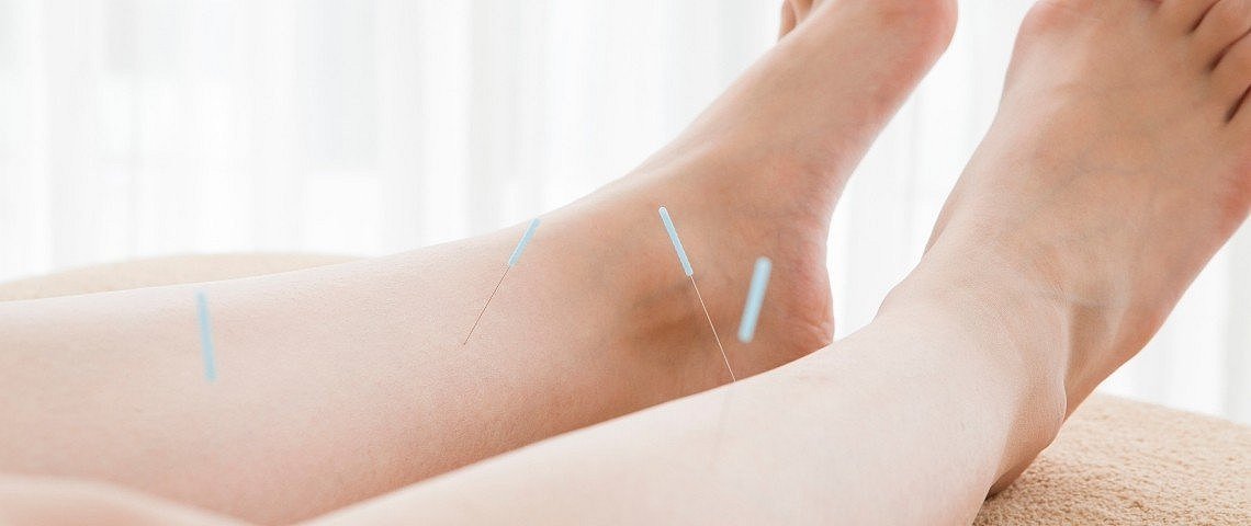 Geburtsvorbereitende Akupunktur in der Schwangerschaft