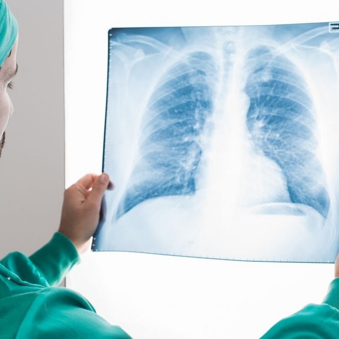 Arzt hält Röntgenaufnahme von Lunge