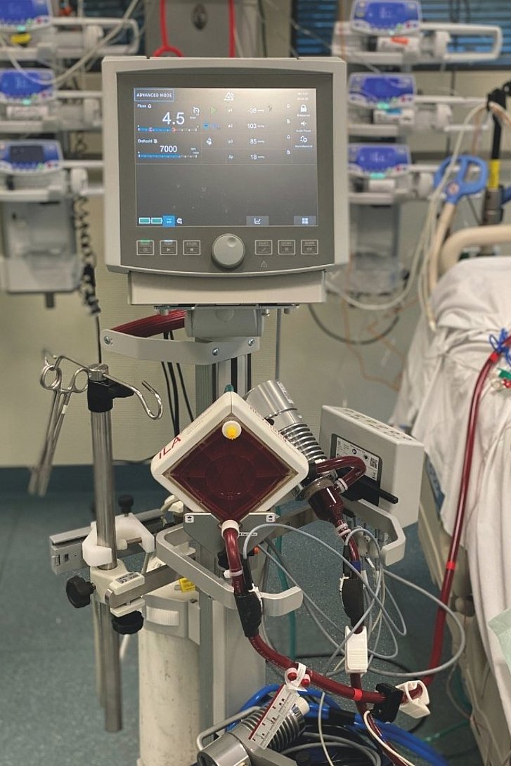 Das ECMO-Gerät kommt bei Patienten zum Einsatz, deren Lunge oder Herz schwerst geschädigt sind.