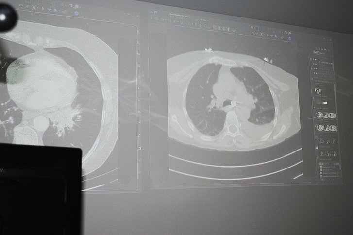 Ultraschall-beim-monatlichen-Emphysemboard