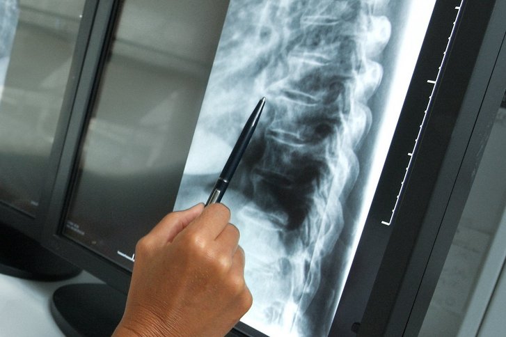Röntgen – bekannt und bewährt