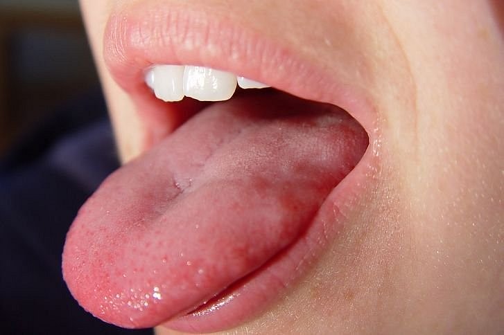 Frau mit geöffnetem Mund und sichtbarer Zunge