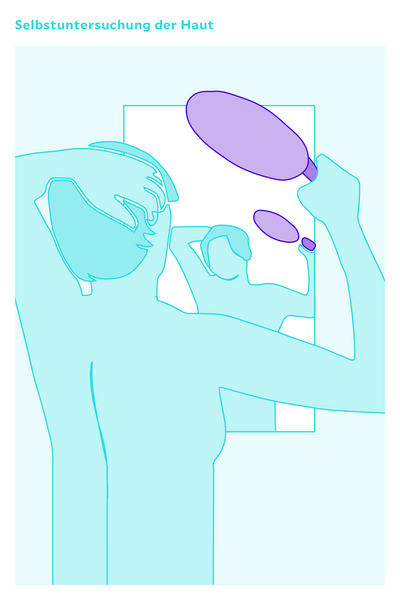 grafische Darstellung zur Selbsuntersuchung der Haut mithilfe eines Spiegels