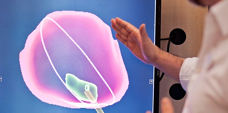 Arzt erläutert die 3D Prostata-Biopsie
