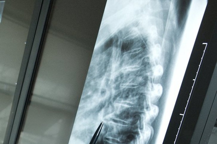 Röntgen – bewährt und bekannt 