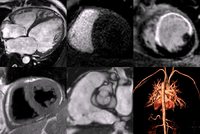 Kardiodiagnostische Aufnahmen des iMRT