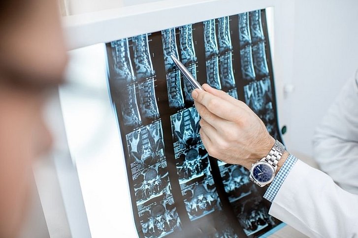 Arzt zeigt auf Röntgenbild