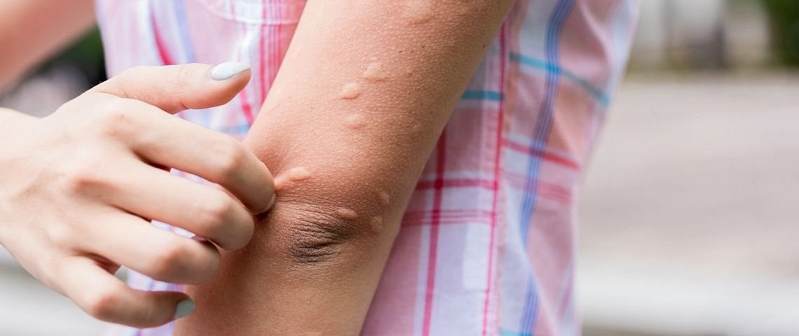 Hautausschlag – was steckt dahinter?