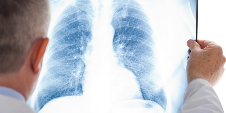 Arzt Lunge Röntgenbild