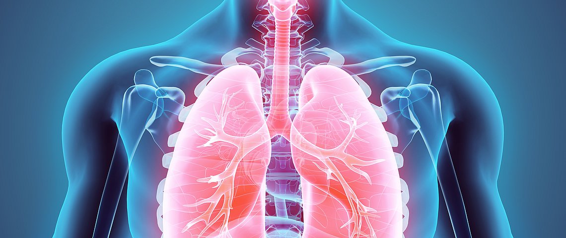 Lungenkrebs ist nicht mehr zwangsläufig ein Todesurteil
