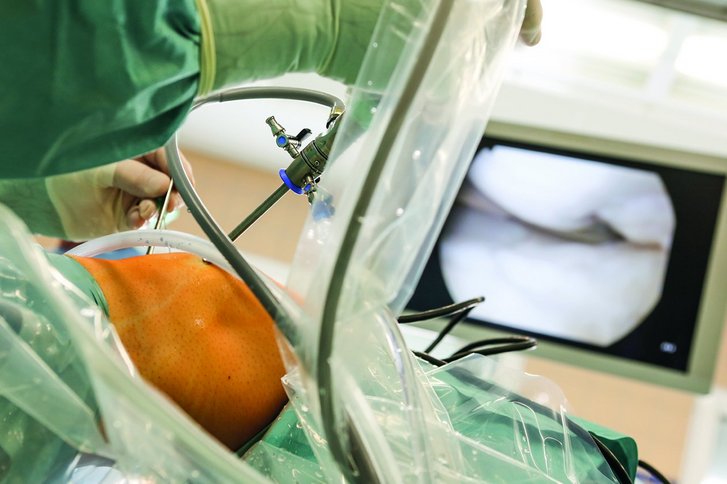 Arthroskopische Operation: Das Gelenk auf dem Bildschirm