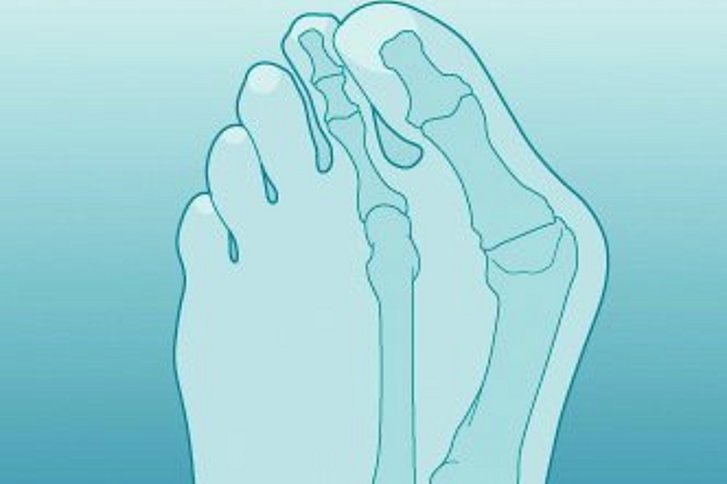 Fuß- und Sprunggelenkchirurgie: Der Fuß - das Fundament unserer Mobilität