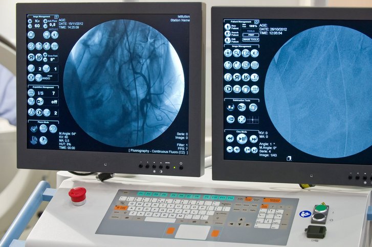 Angiographie - So funktioniert das Röntgen der Blutgefäße