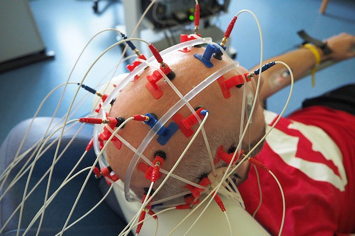 Die Elektroenzephalographie (EEG)